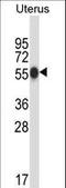 Carboxypeptidase O antibody, LS-C167000, Lifespan Biosciences, Western Blot image 