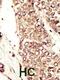 Insulin Like Growth Factor 1 Receptor antibody, GTX25497, GeneTex, Immunohistochemistry paraffin image 