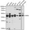 Survival Of Motor Neuron 2, Centromeric antibody, STJ29863, St John