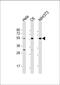 Phosphatase And Tensin Homolog antibody, M00006-4, Boster Biological Technology, Western Blot image 