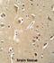 Cartilage Intermediate Layer Protein 2 antibody, abx032662, Abbexa, Immunohistochemistry paraffin image 