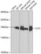 Clathrin Heavy Chain antibody, GTX32526, GeneTex, Western Blot image 