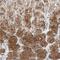 Phosphoribosylglycinamide Formyltransferase, Phosphoribosylglycinamide Synthetase, Phosphoribosylaminoimidazole Synthetase antibody, NBP1-87291, Novus Biologicals, Immunohistochemistry frozen image 