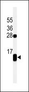 Phospholamban antibody, LS-C163770, Lifespan Biosciences, Western Blot image 