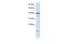 Transmembrane protein 79 antibody, GTX45927, GeneTex, Western Blot image 