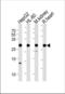 ATP Synthase Peripheral Stalk-Membrane Subunit B antibody, TA328112, Origene, Western Blot image 