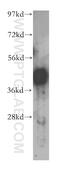 PHD Finger Protein 6 antibody, 51062-1-AP, Proteintech Group, Western Blot image 