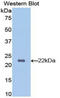 Hemoglobin Subunit Beta antibody, LS-C297115, Lifespan Biosciences, Western Blot image 