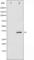 Cyclin Dependent Kinase 2 antibody, abx011803, Abbexa, Western Blot image 