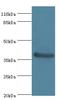 Carbonic Anhydrase 12 antibody, LS-C369345, Lifespan Biosciences, Western Blot image 