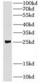 Cysteine Rich Protein 2 antibody, FNab01976, FineTest, Western Blot image 