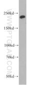 Chromodomain Helicase DNA Binding Protein 1 antibody, 20576-1-AP, Proteintech Group, Western Blot image 