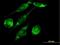 Enoyl-CoA Delta Isomerase 2 antibody, H00010455-B01P, Novus Biologicals, Immunofluorescence image 