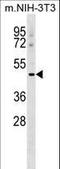 Macrophage Scavenger Receptor 1 antibody, LS-C164653, Lifespan Biosciences, Western Blot image 