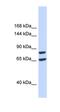 Solute Carrier Family 26 Member 8 antibody, orb330363, Biorbyt, Western Blot image 
