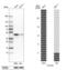 OTU Deubiquitinase With Linear Linkage Specificity antibody, PA5-62309, Invitrogen Antibodies, Western Blot image 
