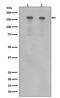 Erb-B2 Receptor Tyrosine Kinase 4 antibody, M00296, Boster Biological Technology, Western Blot image 