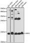 ADP Ribosylation Factor 4 antibody, A7644, ABclonal Technology, Western Blot image 