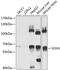 N-Sulfoglucosamine Sulfohydrolase antibody, GTX55796, GeneTex, Western Blot image 