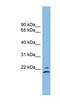 Tetraspanin 1 antibody, NBP1-54405, Novus Biologicals, Western Blot image 