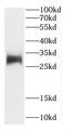 Carbonic Anhydrase 13 antibody, FNab01159, FineTest, Western Blot image 