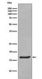 Synuclein Alpha antibody, M00215-1, Boster Biological Technology, Western Blot image 