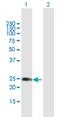 Cellular Communication Network Factor 5 antibody, H00008839-B01P, Novus Biologicals, Western Blot image 