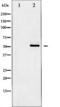 Histone Deacetylase 2 antibody, TA325510, Origene, Western Blot image 