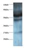 Ganglioside expression factor 2 antibody, LS-C211638, Lifespan Biosciences, Western Blot image 