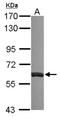 Membrane Palmitoylated Protein 6 antibody, NBP2-15158, Novus Biologicals, Western Blot image 