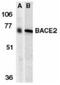 Beta-Secretase 2 antibody, NBP1-77309, Novus Biologicals, Western Blot image 