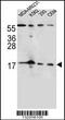 Fibroblast Growth Factor 22 antibody, 56-270, ProSci, Western Blot image 