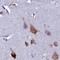 Elongation factor 1-gamma antibody, NBP1-91862, Novus Biologicals, Immunohistochemistry paraffin image 