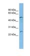 Apolipoprotein B MRNA Editing Enzyme Catalytic Subunit 2 antibody, orb330142, Biorbyt, Western Blot image 