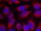 Myristoylated Alanine Rich Protein Kinase C Substrate antibody, GTX50602, GeneTex, Immunocytochemistry image 