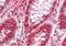 MAT-II antibody, ARP46144_P050, Aviva Systems Biology, Immunohistochemistry paraffin image 