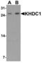 KH Domain Containing 1 antibody, LS-C201109, Lifespan Biosciences, Western Blot image 