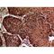Interferon Gamma Receptor 1 antibody, LS-C387156, Lifespan Biosciences, Immunohistochemistry paraffin image 