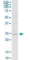 Transmembrane P24 Trafficking Protein 5 antibody, H00050999-B01P, Novus Biologicals, Western Blot image 