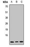 Small Nuclear Ribonucleoprotein Polypeptide F antibody, LS-C668411, Lifespan Biosciences, Western Blot image 