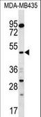 Sorting Nexin 4 antibody, LS-C161374, Lifespan Biosciences, Western Blot image 