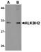 AlkB Homolog 2, Alpha-Ketoglutarate Dependent Dioxygenase antibody, NBP1-76276, Novus Biologicals, Western Blot image 