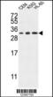 Tetraspanin 2 antibody, 63-894, ProSci, Western Blot image 