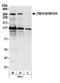 Zinc Finger Protein 638 antibody, NB100-77290, Novus Biologicals, Western Blot image 