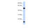 Adenylosuccinate Synthase Like 1 antibody, 26-312, ProSci, Western Blot image 