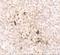 Interleukin 15 antibody, A00212, Boster Biological Technology, Immunohistochemistry paraffin image 