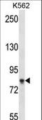 Sterile Alpha Motif Domain Containing 4B antibody, LS-C162857, Lifespan Biosciences, Western Blot image 