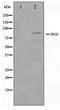 Hepatocyte Growth Factor-Regulated Tyrosine Kinase Substrate antibody, TA347526, Origene, Western Blot image 