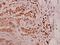 Proteasome 26S Subunit, Non-ATPase 11 antibody, GTX66726, GeneTex, Immunohistochemistry paraffin image 