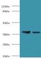 Galactose Mutarotase antibody, MBS1488277, MyBioSource, Western Blot image 